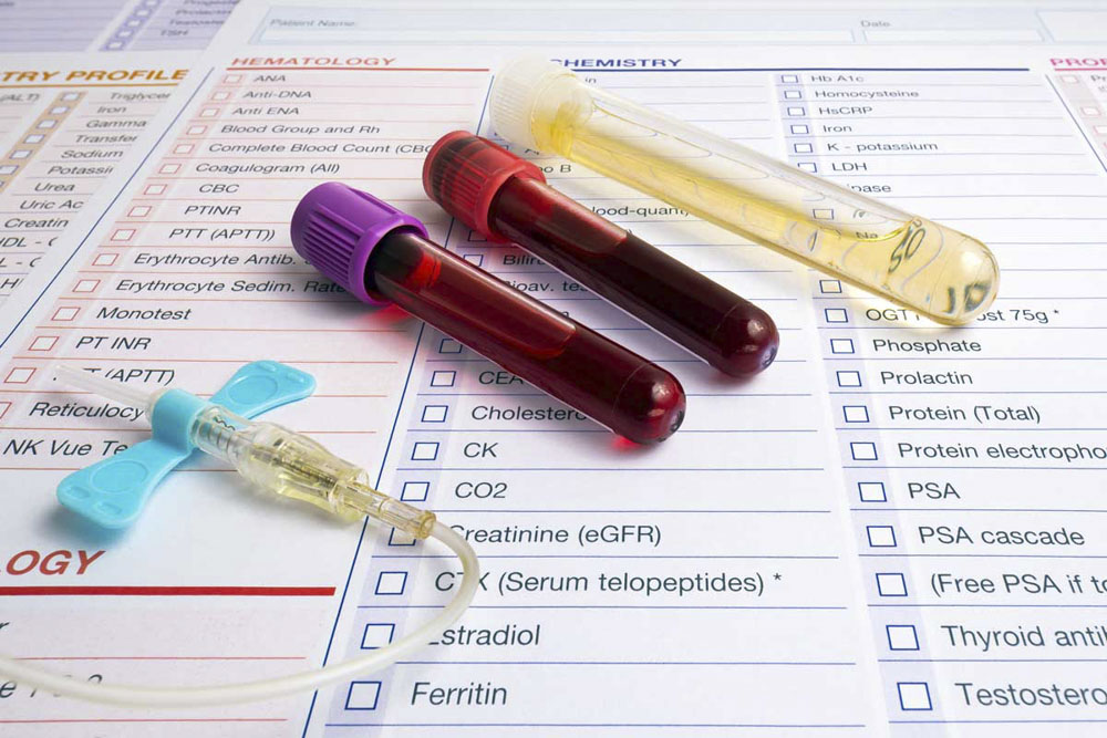 Neu entdeckte Biomarker weisen auf Impfschäden hin